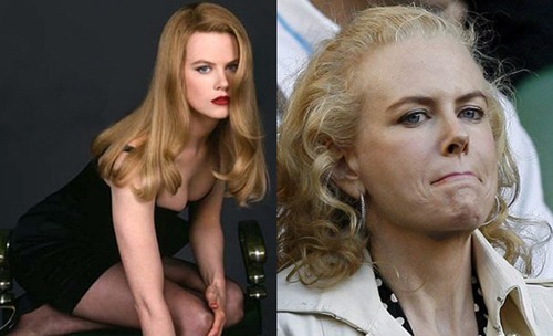 herm-kidman1 herm-kidman1