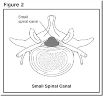 ssfig2