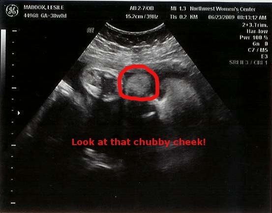 [38Weeks-Edited[3].jpg]