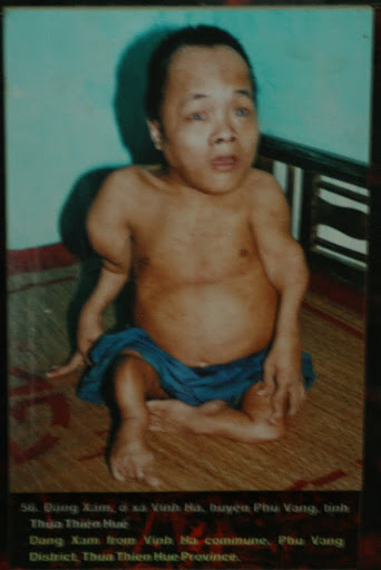 Agent Orange, the stuff that