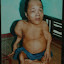 Agent Orange, the stuff that vegetation has nightmare's about, and its side effects on generations to come.