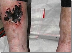 michael-jackson-legs-1