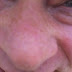 The sun makes Darren's freckles come out