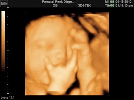 BABY BOY_3