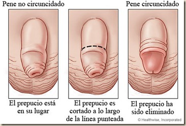 circuncision2