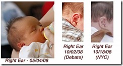 earcomparison