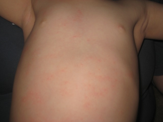 [IMG_09432.jpg]