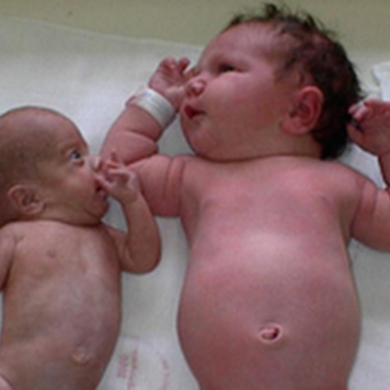 INTRA-UTERINE GROWTH RESTRICTION