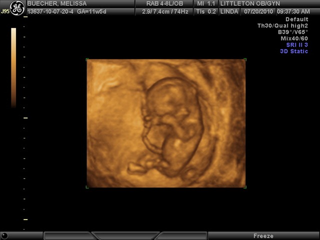 [BABY12WEEKS_33.jpg]