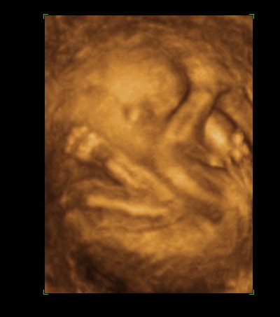 [BABY 20 WEEKS_4[4].jpg]