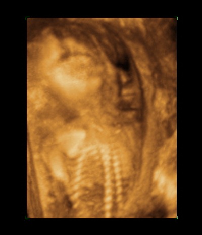 [BABY 20 WEEKS_5[4].jpg]