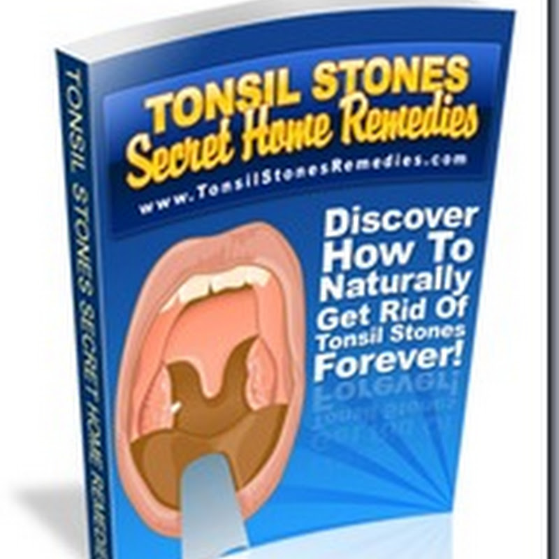 Calcoli tonsillari: Libri sui calcoli tonsillari