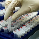 Des chercheurs identifient des variants génétiques liés au vieillissement biologique 