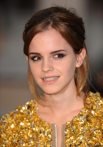 emma watson burberry dress. Emma Watson Burberry Show