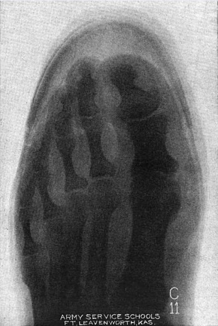 [Munson-X-Ray35.jpg]