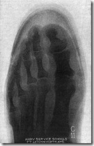 Munson-X-Ray3