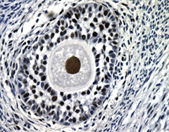 Secondary ovarian follicle in a female lamb. Female lambs had significantly increased numer of ovarian follicles under influence of PCB. (Credit: Marianne Kraugerud)