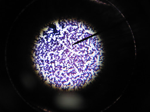 staphylococcus aureus gram stain. staphylococcus aureus gram