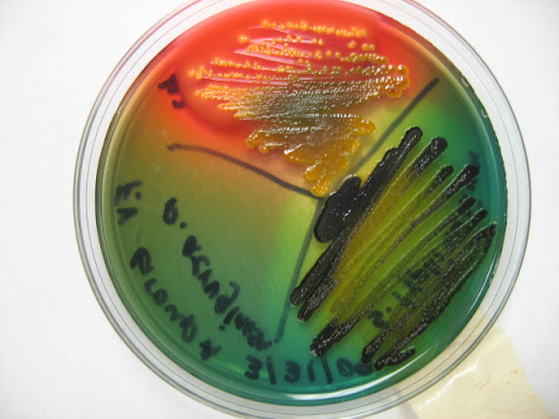 shigella