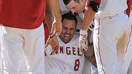 [kendry-morales-injury-image-2347324827442[4].jpg]