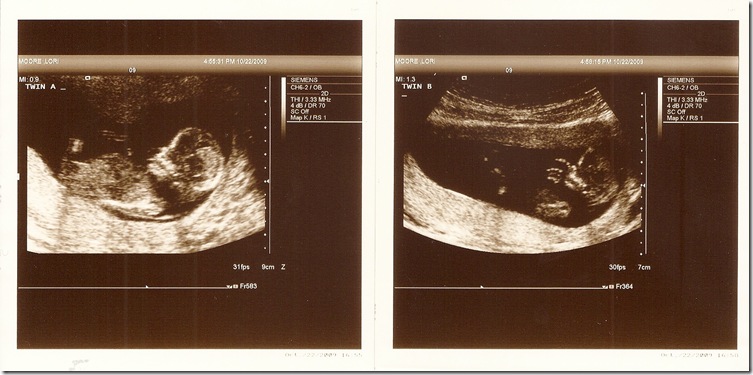 Twins, 12 weeks
