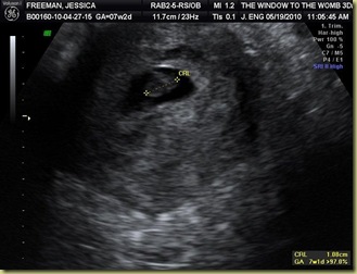 BABY_3 BABY_3