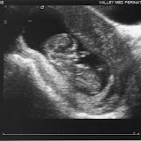 Baby Reid Ultrasounds