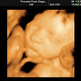 BABY_9.JPG