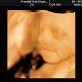 BABY_20.JPG