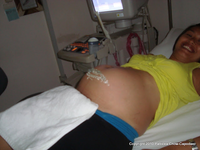 February 18 2010 ultrasound