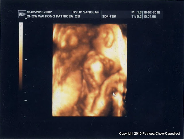 Baby Capodieci 2 3D scan