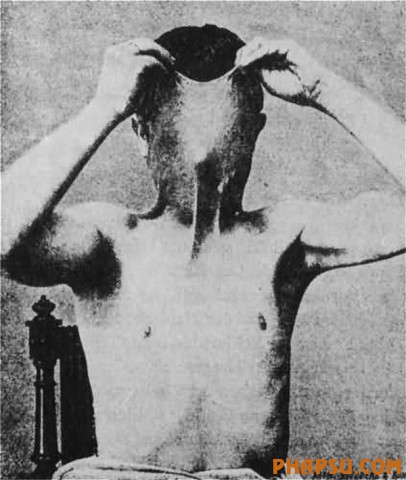 deformities_07.jpg?imgmax=576