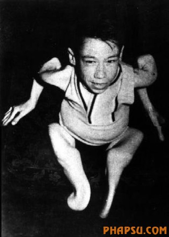 deformities_09.jpg?imgmax=576