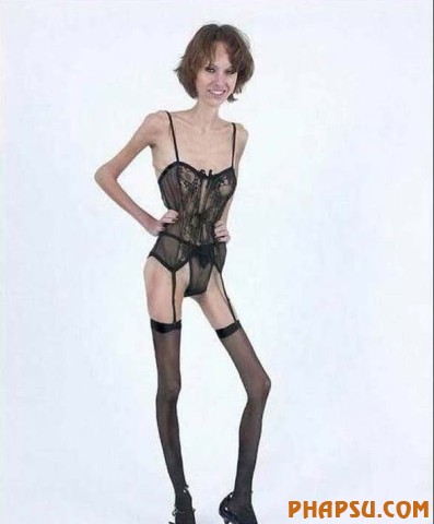deformities_18.jpg?imgmax=576