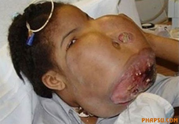 deformities_22.jpg?imgmax=576
