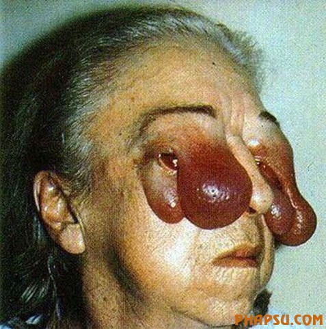 deformities_27.jpg?imgmax=576