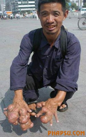 deformities_31.jpg?imgmax=576