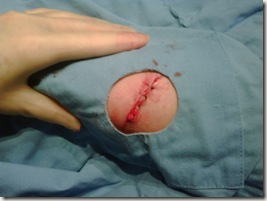Casey's Stitches