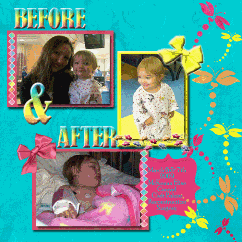 [20090306-Before-After-McKen[2].gif]