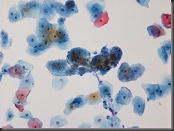 Herper Simplex Virus - 20x