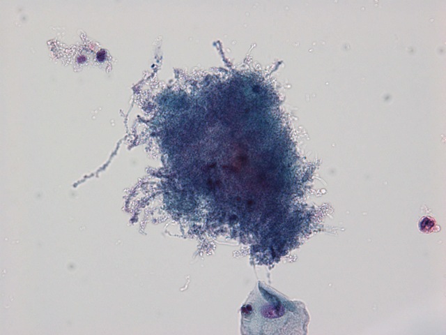 [Actinimycese - 40x[2].jpg]