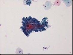 Endocervical Cells - 20x