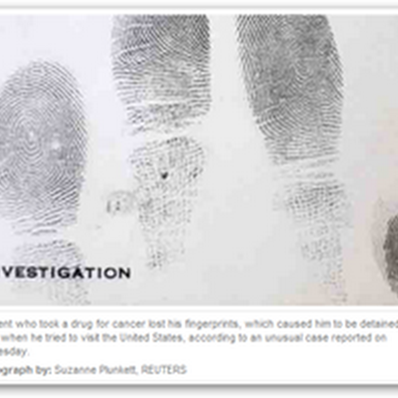 Chemotherapy Drug Causes Patient to lose his Fingerprints - Capecitabine