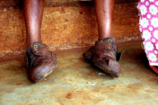 Before Getting New Shoes