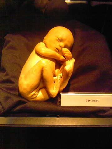 [Body Worlds Exhibit 025[3].jpg]