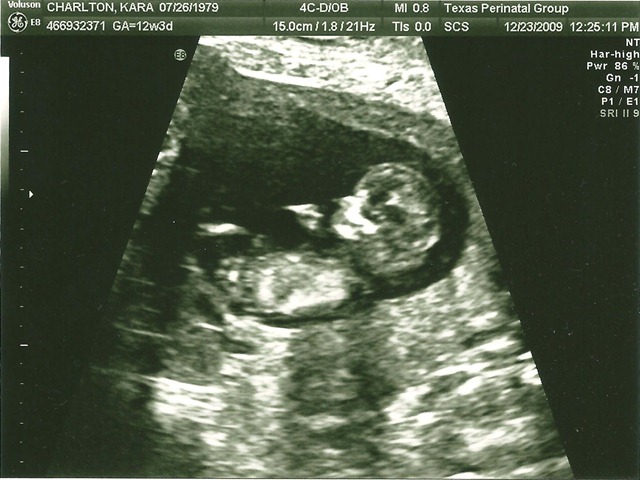 [sonogram2[1].jpg]