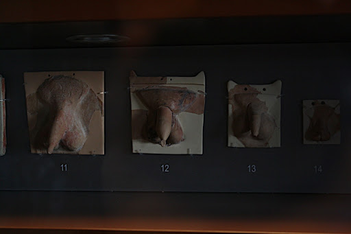 Romans weren't circumcised. As demonstrated by this picture that Facebook ...