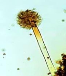 Aspergillus-niger Aspergillus-niger
