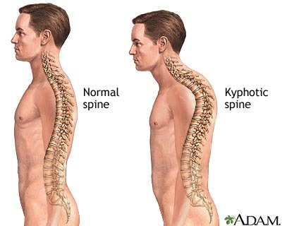 improve posture