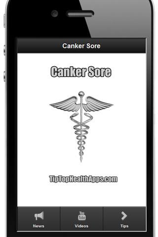 Canker Sore